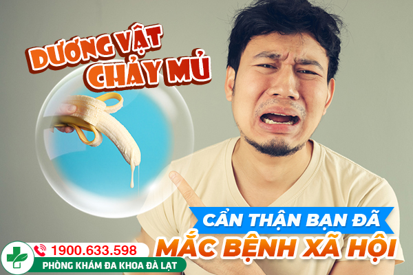 Nguyên nhân và dấu hiệu nhận biết dương vật tiểu buốt có mủ ở nam giới 